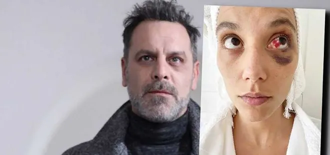 Ozan Güven’e hapis şoku! Darp davasında karar çıktı