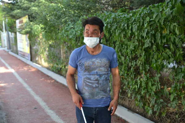 av-tufegi-temizlerken-yuzunun-yarisini-kaybetti-tek-hayali-normal-insanlar-gibi-olmak-1630486514409.jpg Av tüfeği temizlerken yüzünün yarısını kaybetti, tek hayali normal insanlar gibi olmak - 2