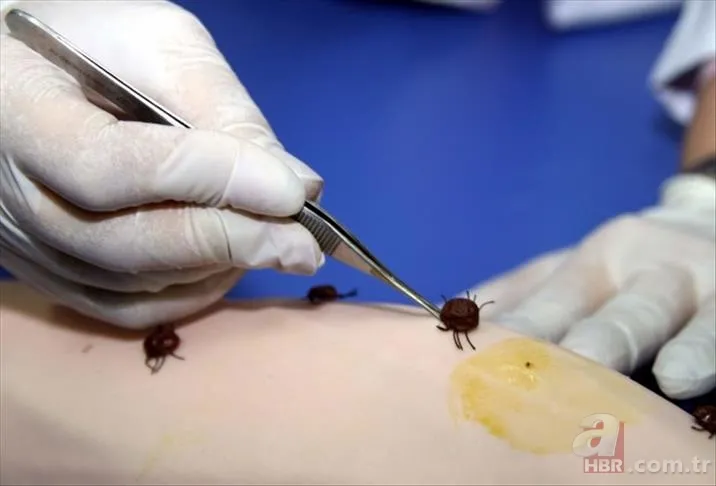 Hızla artıyor! Koronavirüsten daha ölümcül! Kırım Kongo Kanamalı Ateşi (KKKA) hastalığı nedir? Belirtileri neler? 13