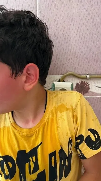 Bu nasıl öğretmen! Öğrencisini kaynar suyla yaktı - 1