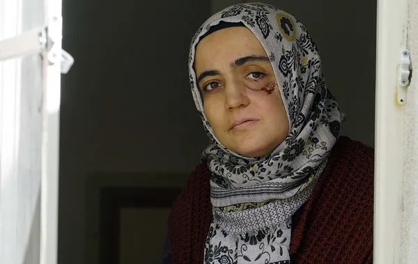 FETÖ’cü Ayşe Özdoğan planı çöktü! Tutanakla kayda alındı! Tedaviyi kendi kabul etmemiş