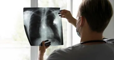 Sabah yaşadığınız bu duruma dikkat: Akciğer kanseri belirtisi olabilir!