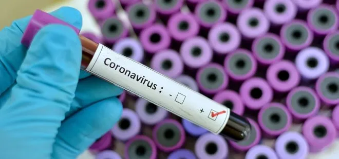 DSÖ’den koronavirüs açıklaması: Salgın bitme noktasından çok uzak