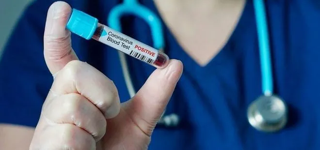 ABD’de 24 saatlik koronavirüs bilançosu: 304 kişi hayatını kaybetti