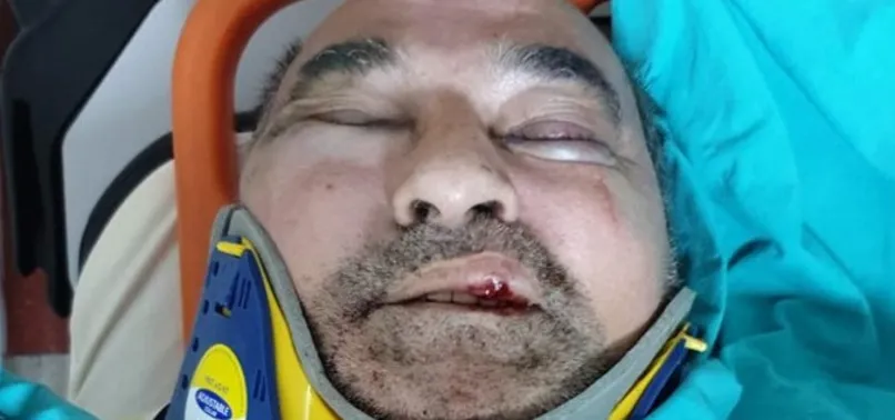 Kuşadası Belediyesi için usulsüzlük iddiasında bulunan gazeteci-yazar Ergun Poyraz'a darp! PKK-KCK detayı...