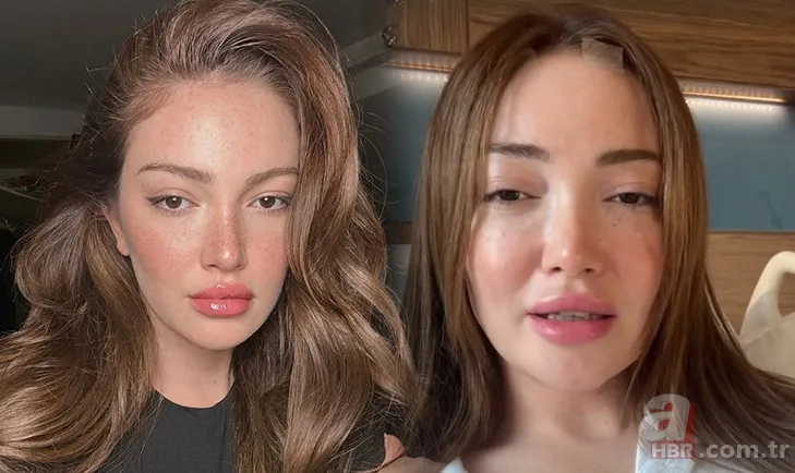 4. kez ameliyat olan Danla Bilic'in vücudundan çıkanlar şoke etti 1