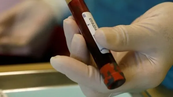 Hangi kan grubu daha sağlıklı? Hava kirliliğine karşı en dirençli kan grubu hangisi? İngiltere’deki flaş araştırma sonuçlandı