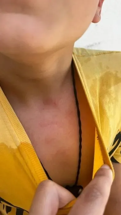 Bu nasıl öğretmen! Öğrencisini kaynar suyla yaktı - 3