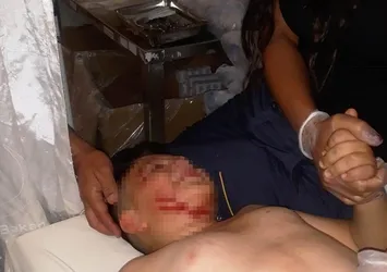 Konya’da başıboş köpek dehşet saçtı! Küçük çocuğa 40 dikiş atıldı