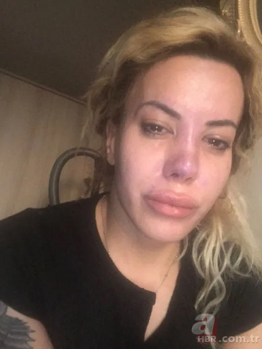 Survivor yarışmacısı Yunus Emre Özden hakkında şok suçlama! Sevgilisine kabusu yaşattı 3