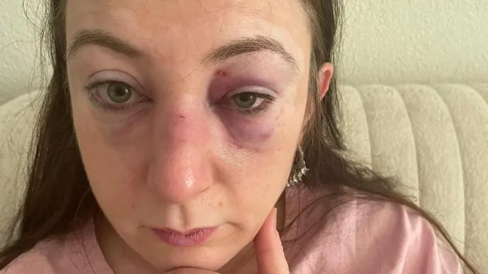 Sibel Kahraman'a kabusu yaşattı! Kahraman'ın sözleri kan dondurdu: 9 kafa darbesi, vücudunda sigara söndürme...