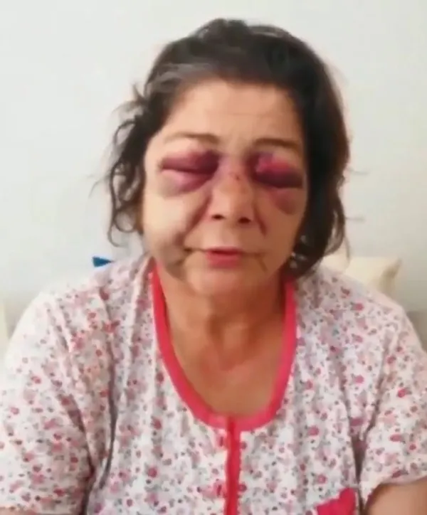 CHP’li Eynesil Belediye Başkanı Ahmet Latif Karadeniz kadına şiddet uygulattı! Sözde aydınlar ve CHP medyasından ses çıkmadı