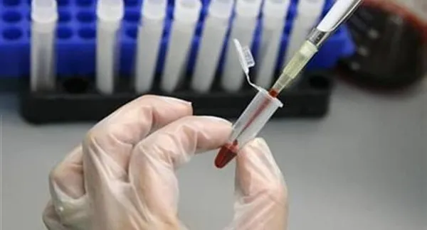 1651046967111.jpg İngiltere'de ortaya çıkan gizemli hepatit hızla yayılıyor! Kanada'da da görüldü - 4