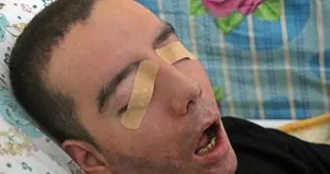 10 yıldır gözlerini kırpmadan yaşıyor!