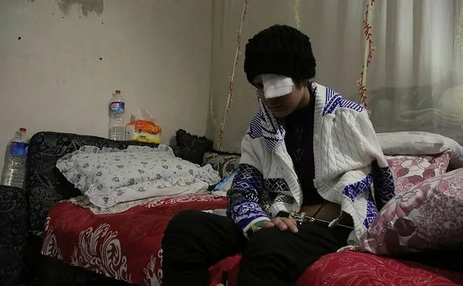YPG'nin döşediği mayınlar hayatlarını kararttı! 15 yaşındaki Dua Zeki'nin gözü görmüyor, bacakları sakat - 2