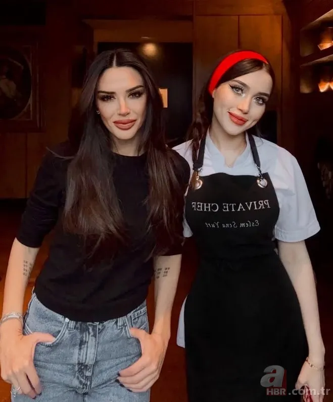 Eski MasterChef yarışmacısı bıçaklandı! Eslem Sena Yurt yaşadığı olayı anlattı 5