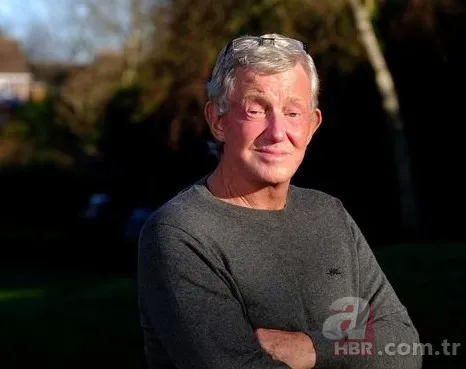 3 senedir gözlerini kapatamıyor! Sağlığına kavuşmak için Türkiye’ye geldi 1