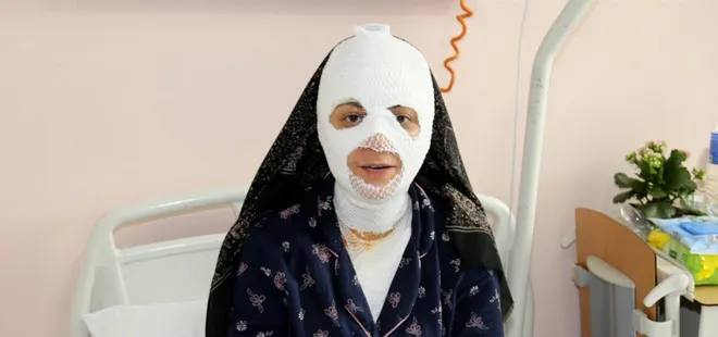 Patlayan düdüklü tencere hastanelik etti