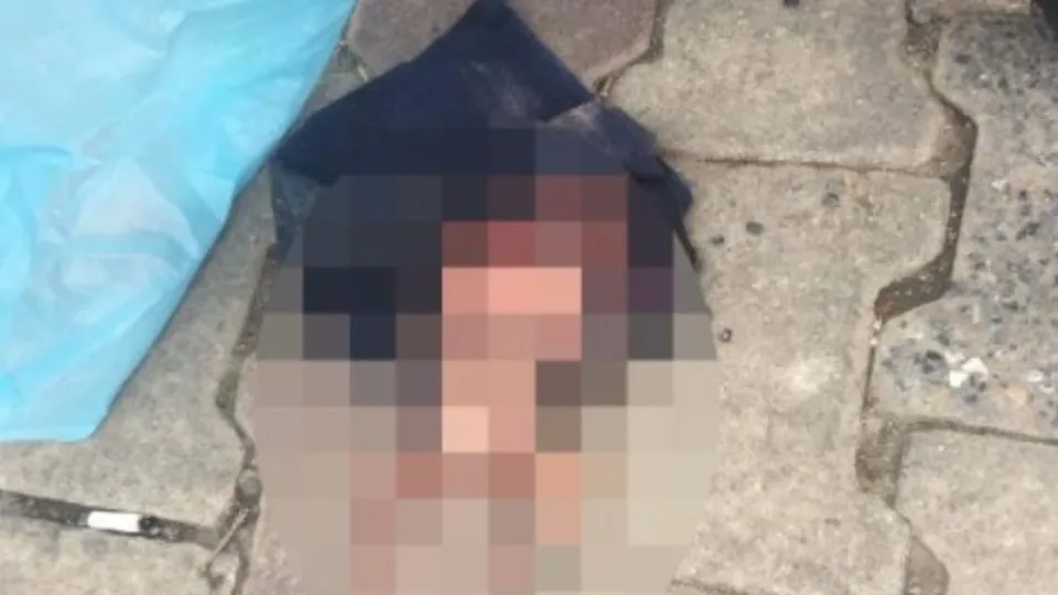 Başakşehir'de ağaçlık alanda 4 aylık cenin bulundu