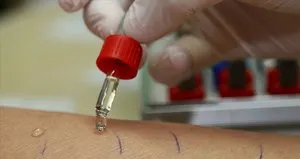Alerji testinin pozitif çıkması aktif bir alerji olduğunu göstermeyebilir!
