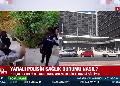 Yaralı polisin sağlık durumu nasıl?