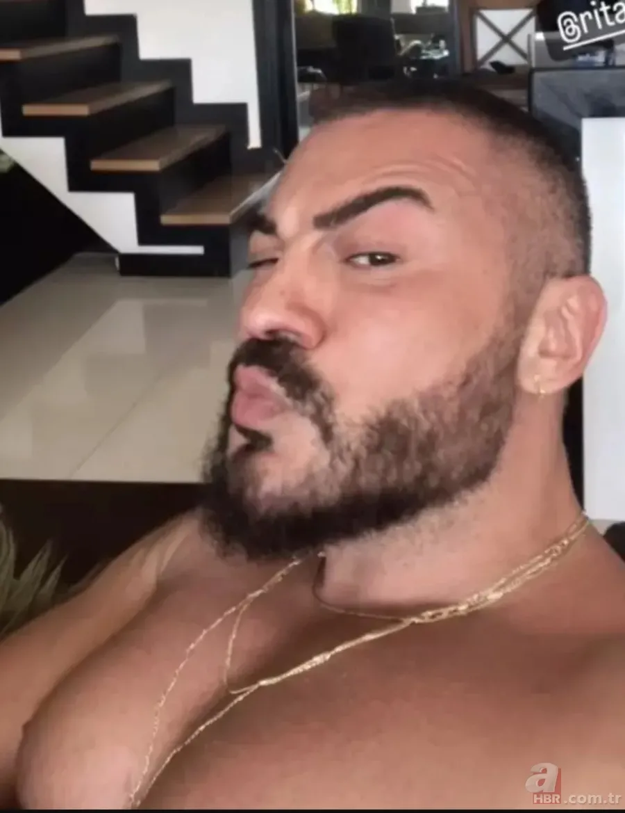 Rober Hatemo'nun son görüntüsü olay oldu! Yüzüne bakın ne yaptırmış! 'Yenilendim' 3