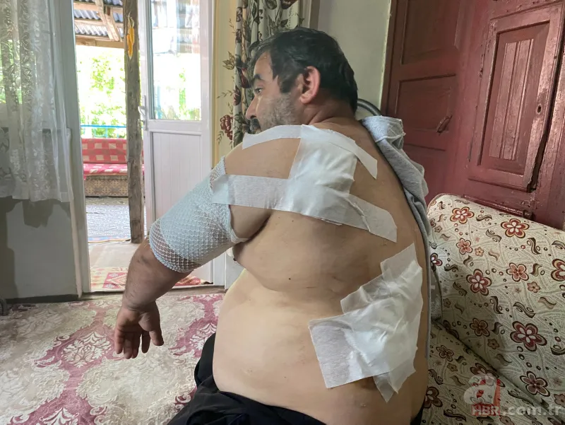Bartın'da ayı saldırısı! 65 dikiş atıldı: Öldüğümü sanıp bıraktı 11
