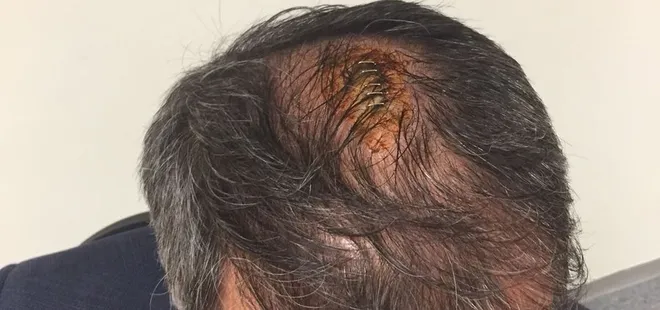 Şenol Güneş’in kafasına 5 dikiş atıldı!