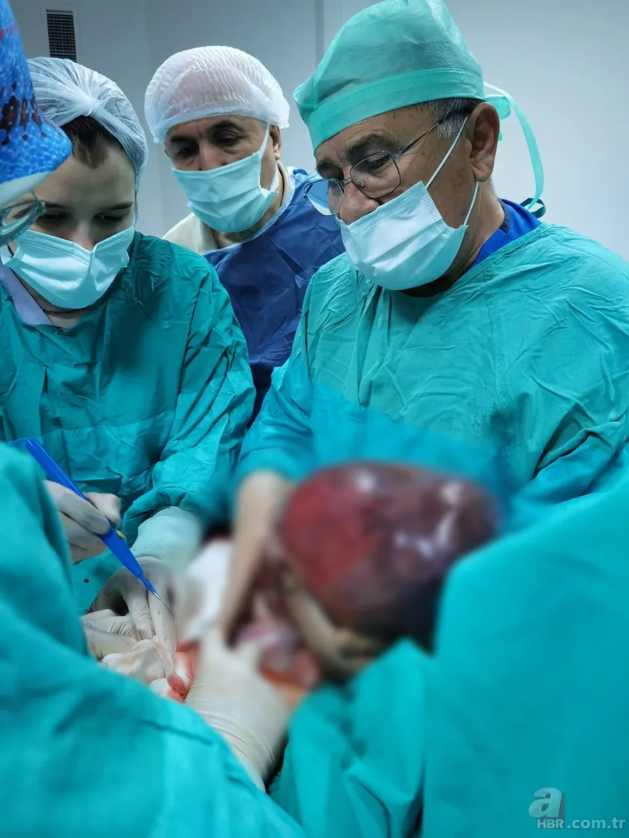 Amasya’da 22 yaşındaki genç kız karın ağrısı şikayetiyle hastaneye gitti! Gerçek şoke etti: Tam 5 kilo 4