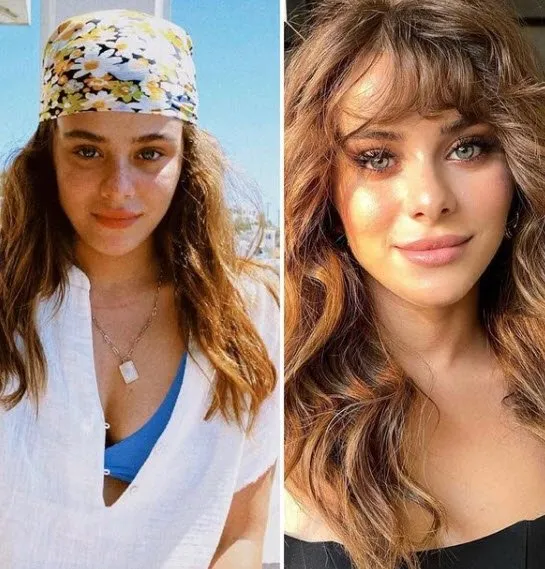 Kalp Yarası’nın Ayşe’si Yağmur Tanrısevsin’in estetiksiz hali pes