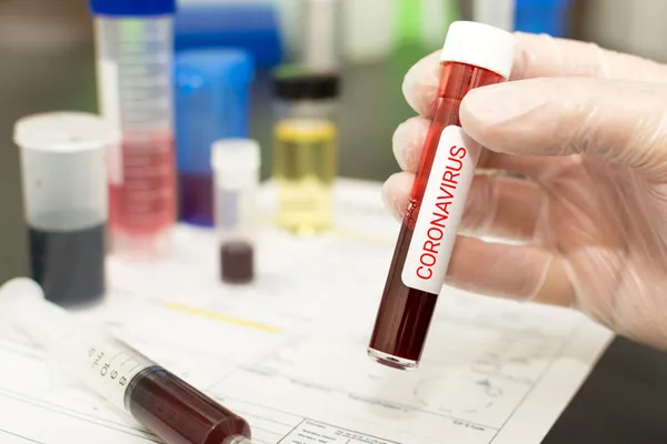 İngiliz ordusu korona virüsü (Covid-19) öldüren madde buldu | Stok yapıyorlar... - 6