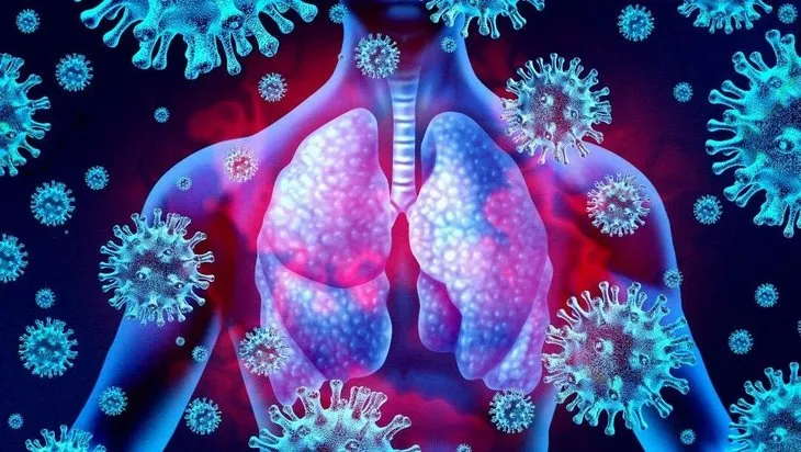 Koronavirüs ciğerlere inerse ne olur? Koronavirüs akciğerleri nasıl etkiliyor? Virüs ciğerleri bu hale getiriyor