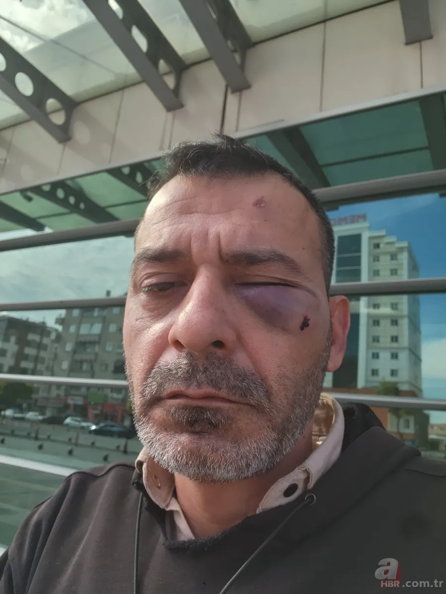 Sosyal medya fenomenine kanlı pusu! Hırsızlık süsüyle tuzağa çektiler: Öleceğini zannedip şehadet getirdi 5