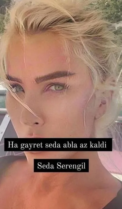 Seda Sayan Fransiz Askisi Operasyonu Sonrasi Ilk Kez Goruntulendi
