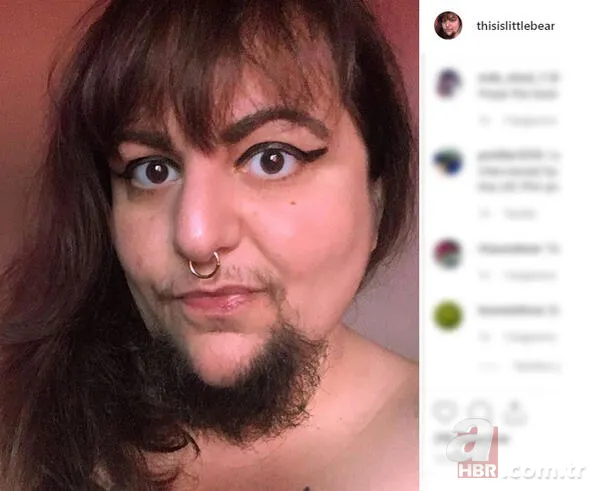 Sakallı kadın görenleri şaşırtıyor! Ölüm tehditleri... 3