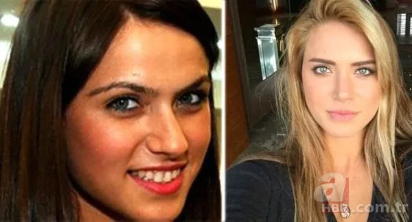 Ceyda Ateş’ten estetik itirafı! Set kazası kabusu oldu 3 kez ameliyat masasına yattı 10