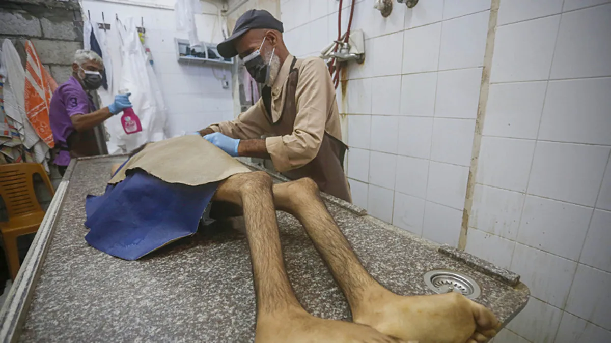 İsrail 2 Filistinliyi daha açlıkla katletti