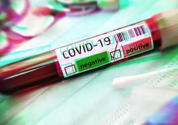 Ziraat Türkiye Kupası maçı öncesi BB Erzurumspor'da koronavirüs şoku!