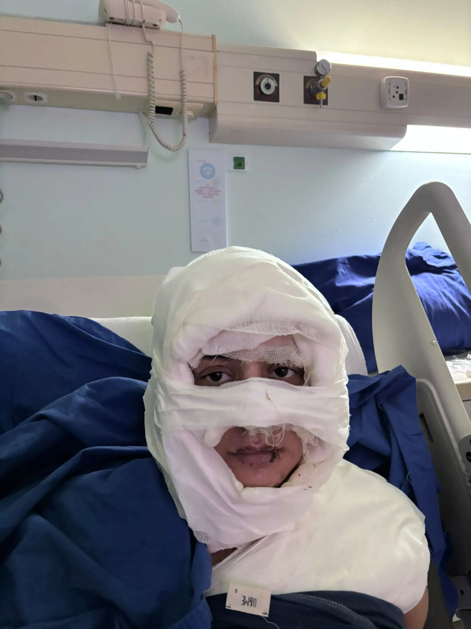 Kadıköy'de kadına kolonya ile dehşeti yaşatmıştı! Sanıktan pes dedirten savunma