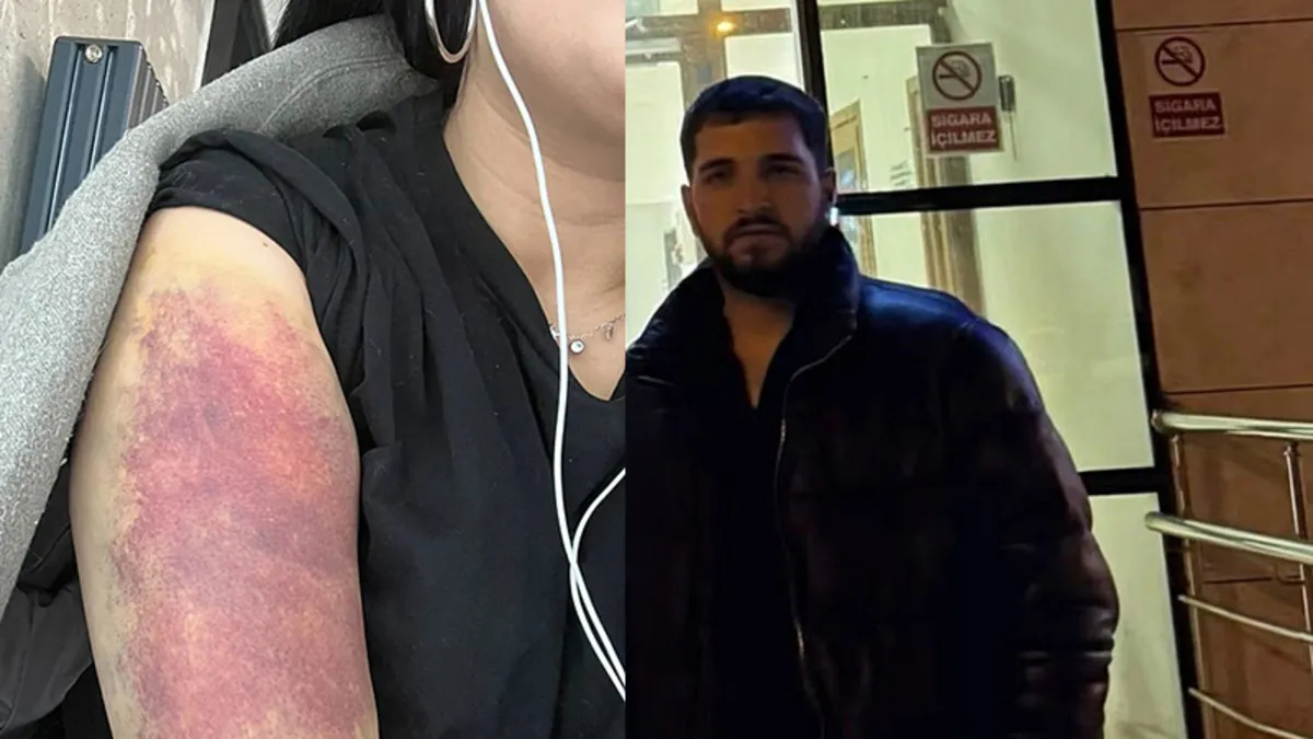 Esenyurt'ta sevgili dehşet saçtı! Genç kadını dakikalarca darp etti: Kedini de öldürürüm