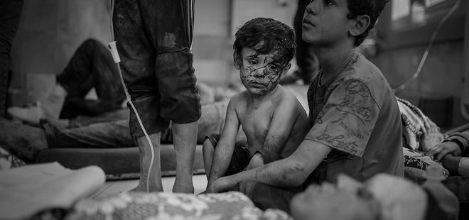 Gazze’de çocuklar açlıktan ölüyor! BM’den korkunç rapor