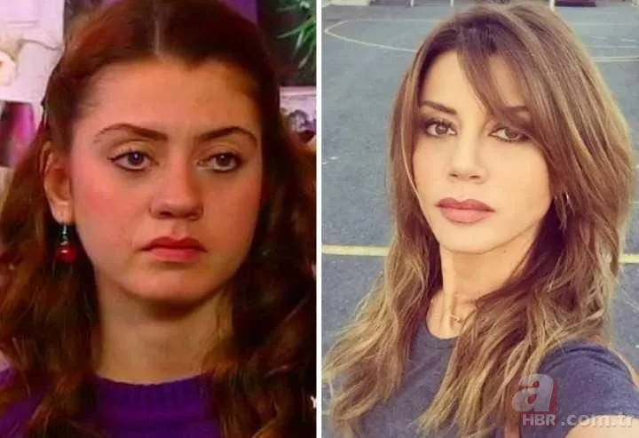 Bir Zamanlar Çukurova’nın Gülten’i Selin Genç de estetik harikası çıktı! Eski hali şoke etti 3