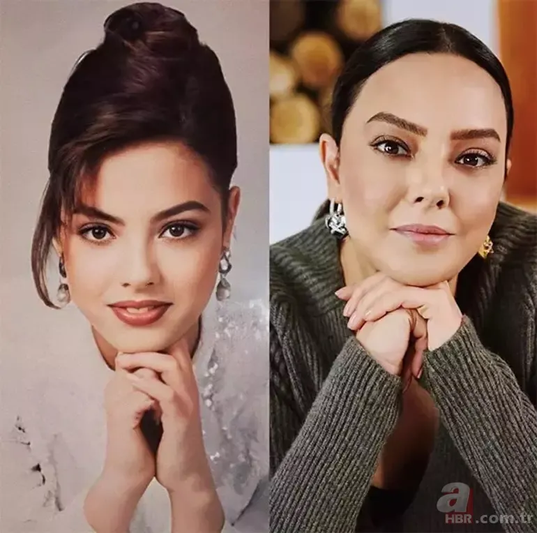 Estetik modasına uyan Ebru Gündeş tanınmaz hale geldi! “Yok olmuş” 12