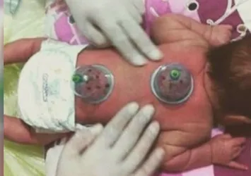 Bu görüntüler büyük tepki çekmişti! Uzmanlardan uyarı geldi