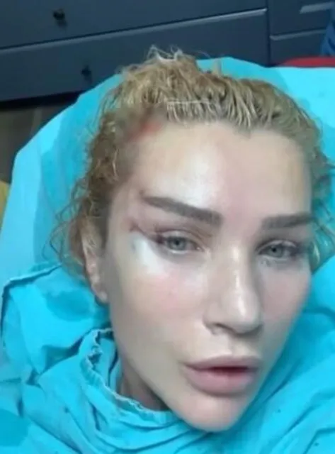 seda-sayan-ajda-pekkanin-estetik-rekoruna-goz-dikti-1619335549169.jpg Seda Sayan Ajda Pekkan'ın rekoruna göz dikti - 1