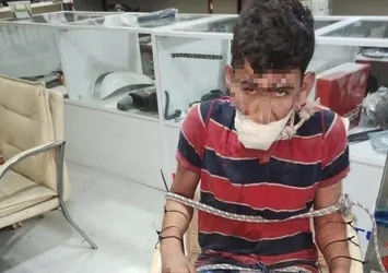 Kerpetenle dişlerini söküp hamamböceği yedirdiler! Antalya'da kan donduran işkence: 4 yıldır kabuslarla uyanıyor