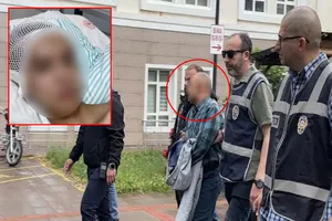 Tacize direndiğim için başımdan vurdu