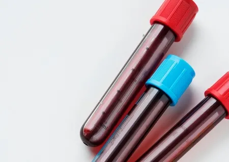 Dünyanın en değerli kanı: Rh-null! Nadir bulunuyor, altın kan olarak anılıyor