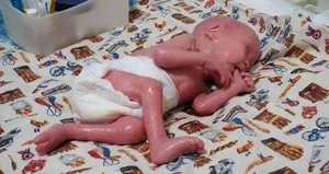 Yılan bebek davasında hakimden şok karar!