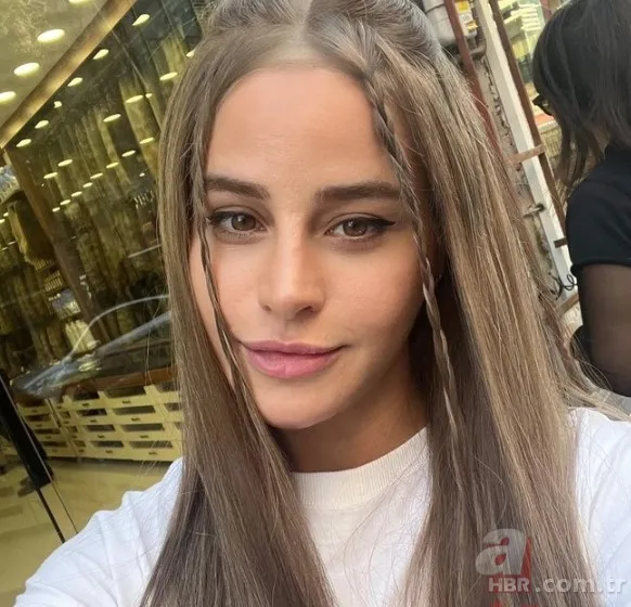 Büşra Pekin’de estetikle yeni birine dönüşenler kervanında! 1 estetiğim var deyince ti’ye alınmıştı… 4 bantla o hale gelmiş! 21